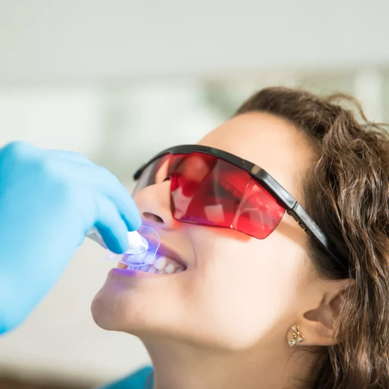 Sistema de Blanqueamiento Dental en Clínica PrevDent CrWR