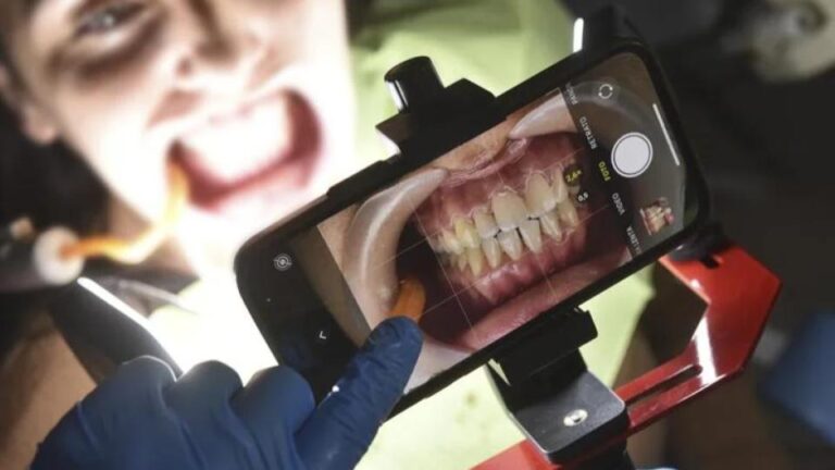 Fotografía odontológica en curso práctico para dentistas en Barcelona